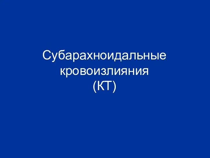 Субарахноидальные кровоизлияния (КТ)