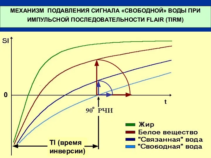 МЕХАНИЗМ ПОДАВЛЕНИЯ СИГНАЛА «СВОБОДНОЙ» ВОДЫ ПРИ ИМПУЛЬСНОЙ ПОСЛЕДОВАТЕЛЬНОСТИ FLAIR (TIRM) TI (время инверсии) 0