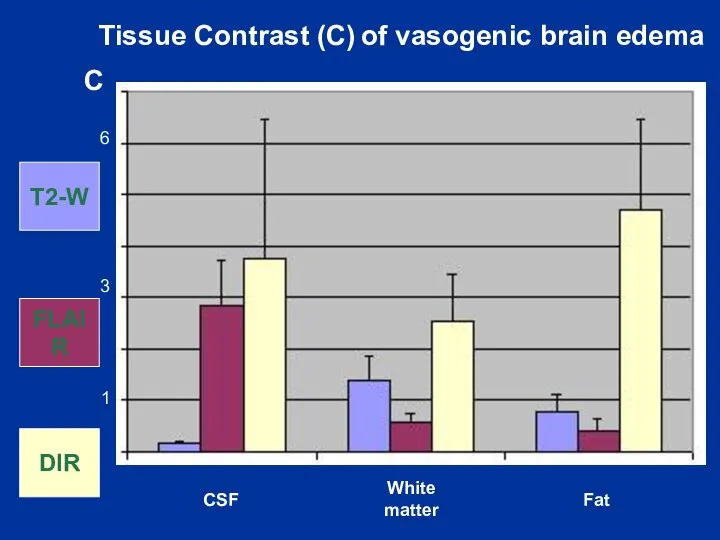 Tissue Contrast (C) of vasogenic brain edema C T2-W FLAIR DIR