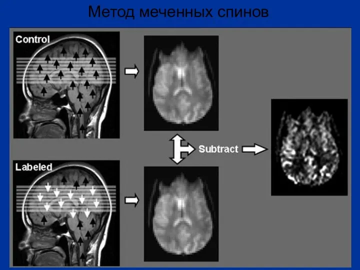 Метод меченных спинов