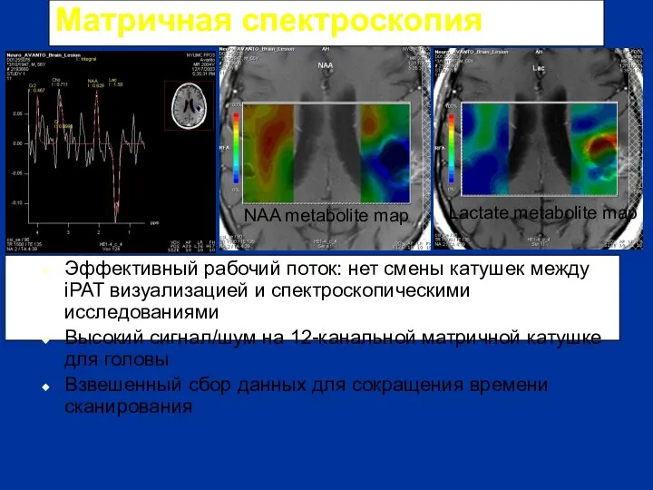 NAA metabolite map Lactate metabolite map Матричная спектроскопия Эффективный рабочий поток: