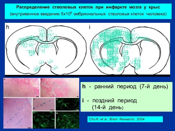Распределение стволовых клеток при инфаркте мозга у крыс (внутривенное введение 5х106