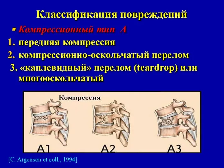 Классификация повреждений Компрессионный тип А передняя компрессия компрессионно-оскольчатый перелом 3. «каплевидный»