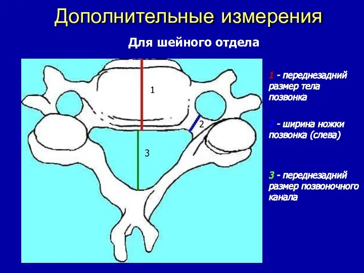 Дополнительные измерения Для шейного отдела 1 - переднезадний размер тела позвонка