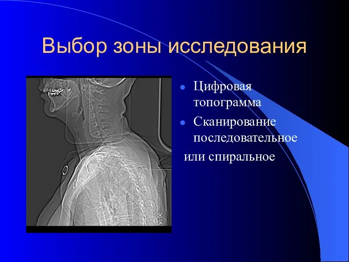 Выбор зоны исследования Цифровая топограмма Сканирование последовательное или спиральное