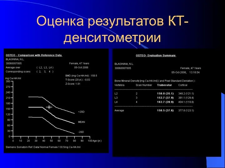 Оценка результатов КТ-денситометрии