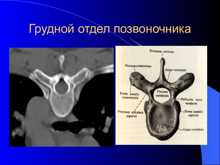 Грудной отдел позвоночника