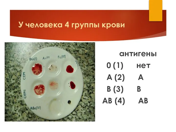 У человека 4 группы крови антигены 0 (1) нет А (2)