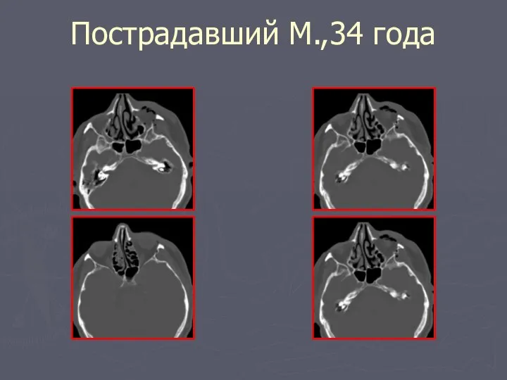 Пострадавший М.,34 года