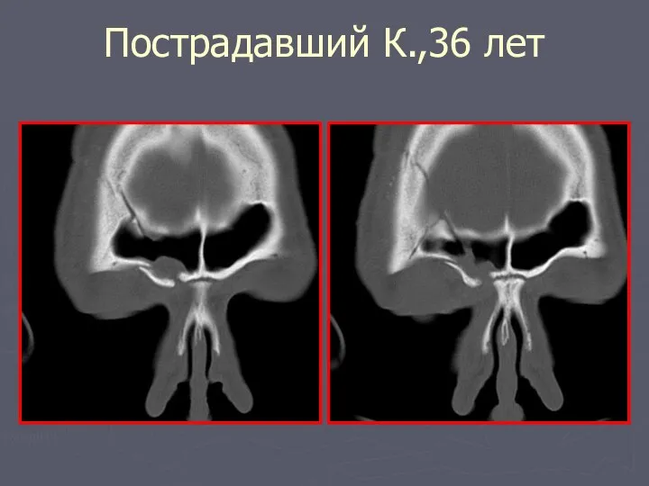 Пострадавший К.,36 лет