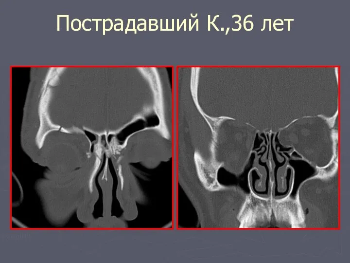 Пострадавший К.,36 лет