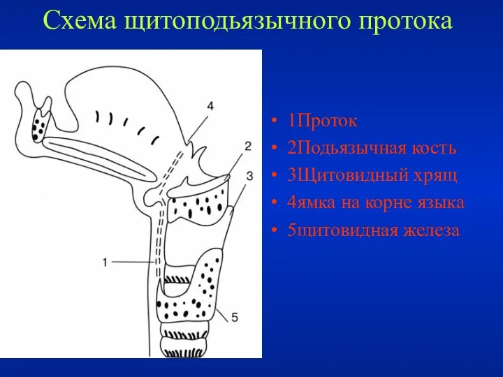 Схема щитоподьязычного протока 1Проток 2Подьязычная кость 3Щитовидный хрящ 4ямка на корне языка 5щитовидная железа