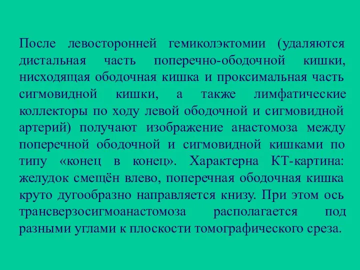 После левосторонней гемиколэктомии (удаляются дистальная часть поперечно-ободочной кишки, нисходящая ободочная кишка