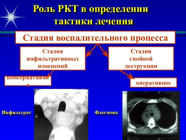 Роль РКТ в определении тактики лечения Инфильтрат Флегмона Стадия воспалительного процесса