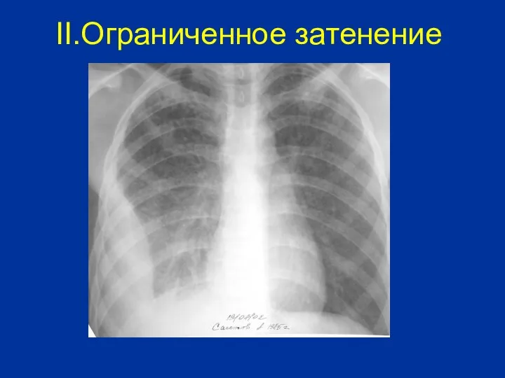 II.Ограниченное затенение