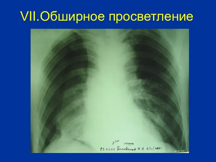 VII.Обширное просветление