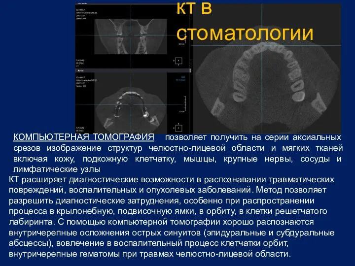 кт в стоматологии КОМПЬЮТЕРНАЯ ТОМОГРАФИЯ позволяет получить на серии аксиальных срезов