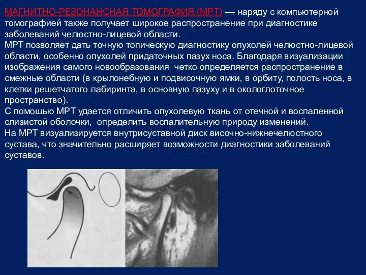 МАГНИТНО-РЕЗОНАНСНАЯ ТОМОГРАФИЯ (МРТ) –– наряду с компьютерной томографией также получает широкое