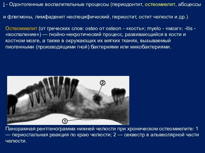 I - Одонтогенные воспалительные процессы (периодонтит, остеомиелит, абсцессы и флегмоны, лимфаденит