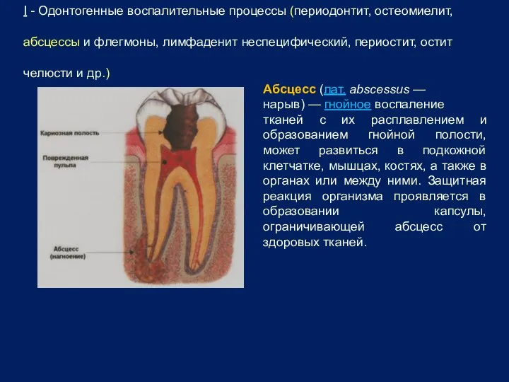 I - Одонтогенные воспалительные процессы (периодонтит, остеомиелит, абсцессы и флегмоны, лимфаденит