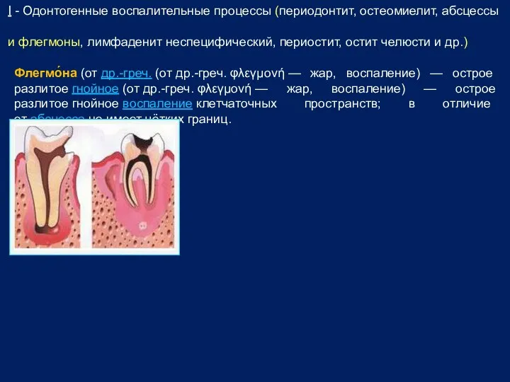 I - Одонтогенные воспалительные процессы (периодонтит, остеомиелит, абсцессы и флегмоны, лимфаденит