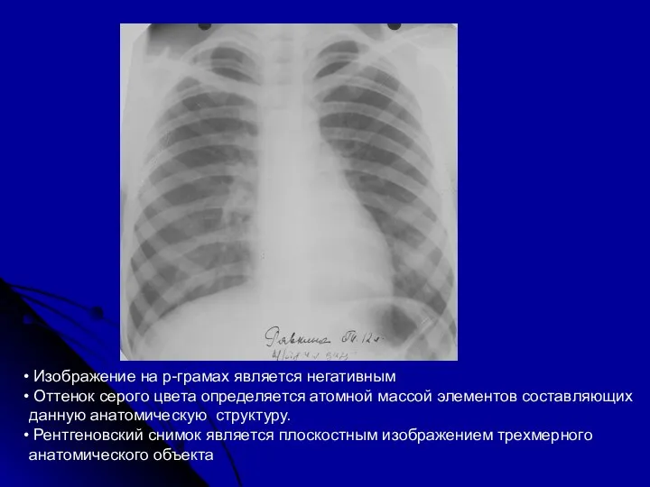 Изображение на р-грамах является негативным Оттенок серого цвета определяется атомной массой