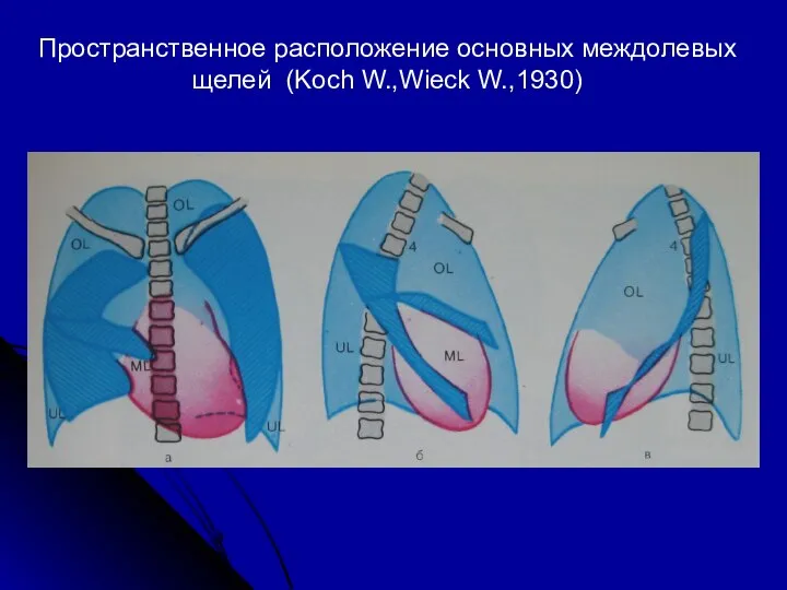 Пространственное расположение основных междолевых щелей (Koch W.,Wieck W.,1930)