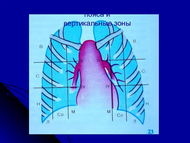 Деление легочных полей на горизонтальные пояса и вертикальные зоны