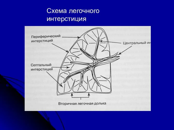 Схема легочного интерстиция