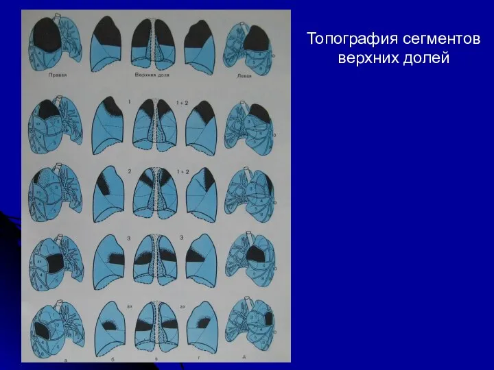 Топография сегментов верхних долей