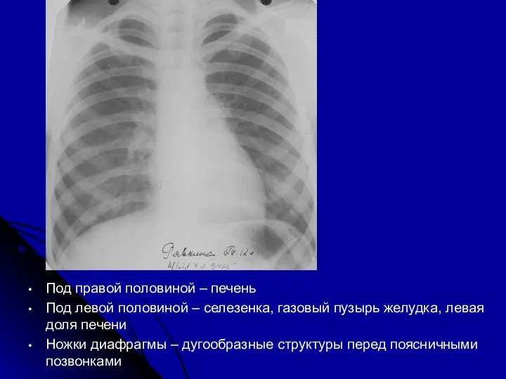 Под правой половиной – печень Под левой половиной – селезенка, газовый