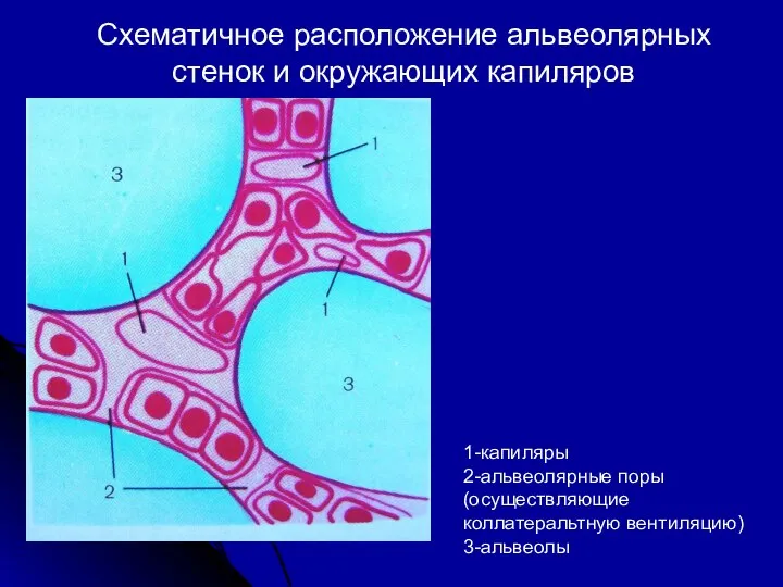 Схематичное расположение альвеолярных стенок и окружающих капиляров 1-капиляры 2-альвеолярные поры (осуществляющие коллатеральтную вентиляцию) 3-альвеолы