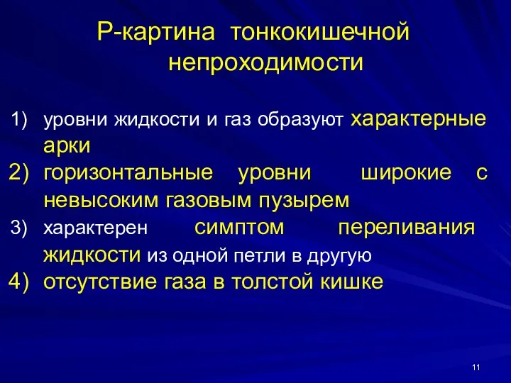 Р-картина тонкокишечной непроходимости уровни жидкости и газ образуют характерные арки горизонтальные