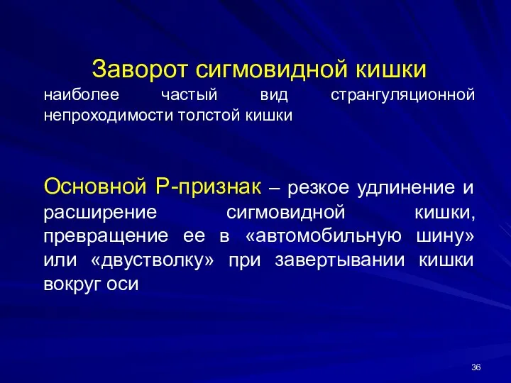 Заворот сигмовидной кишки наиболее частый вид странгуляционной непроходимости толстой кишки Основной