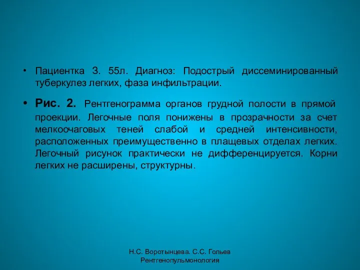 Н.С. Воротынцева. С.С. Гольев Рентгенопульмонология Пациентка З. 55л. Диагноз: Подострый диссеминированный