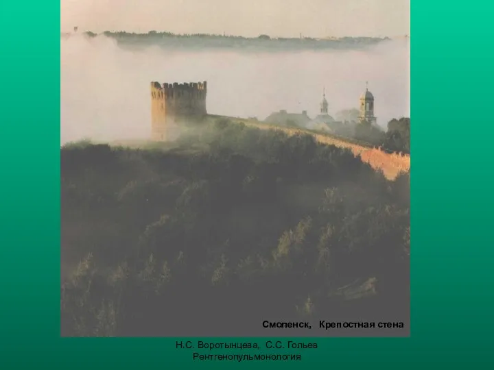 Н.С. Воротынцева, С.С. Гольев Рентгенопульмонология Смоленск, Крепостная стена