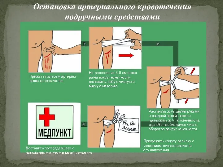 Остановка артериального кровотечения подручными средствами Прижать пальцем артерию выше кровотечения На