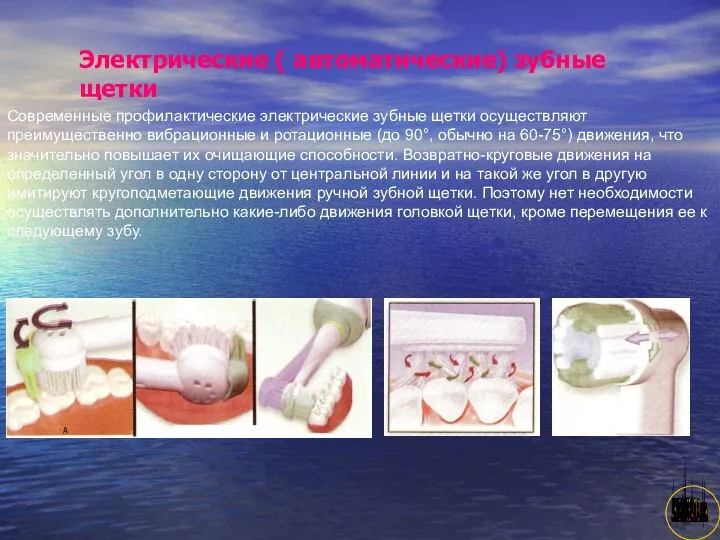 АНИСИМОВА Л.В.кмн. Электрические ( автоматические) зубные щетки Современные профилактические электрические зубные