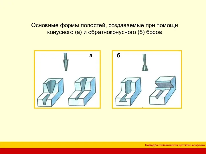 Основные формы полостей, создаваемые при помощи конусного (а) и обратноконусного (б) боров а б