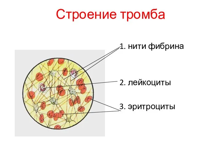 Строение тромба 1. нити фибрина 2. лейкоциты 3. эритроциты