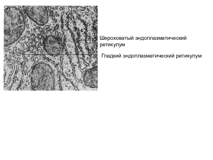 Шероховатый эндоплазматический ретикулум Гладкий эндоплазматический ретикулум