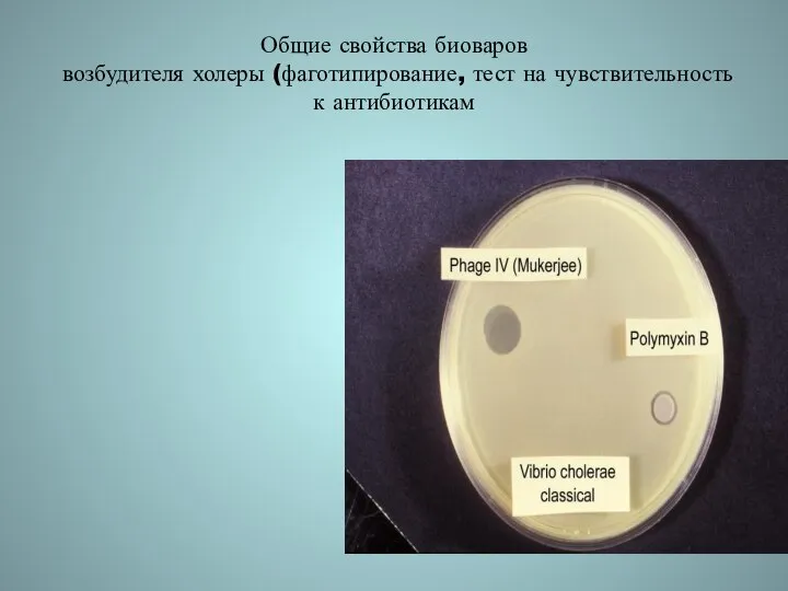 Общие свойства биоваров возбудителя холеры (фаготипирование, тест на чувствительность к антибиотикам