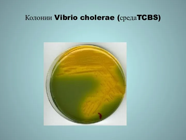 Колонии Vibrio cholerae (средаTCBS)