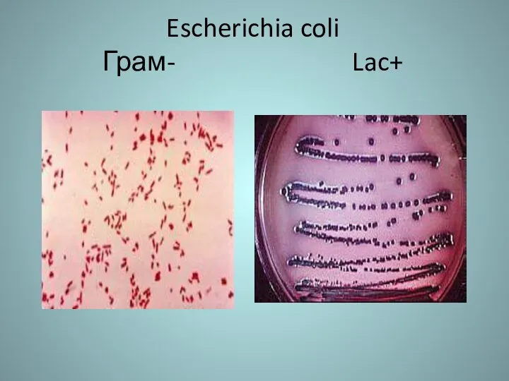 Escherichia coli Грам- Lac+