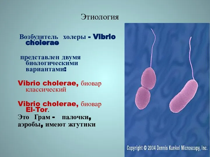 Этиология Возбудитель холеры - Vibrio cholerae представлен двумя биологическими вариантами: Vibrio