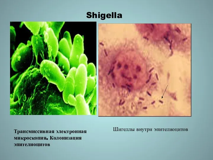 Shigella Трансмиссивная электронная микроскопия. Колонизация эпителиоцитов Шигеллы внутри эпителиоцитов