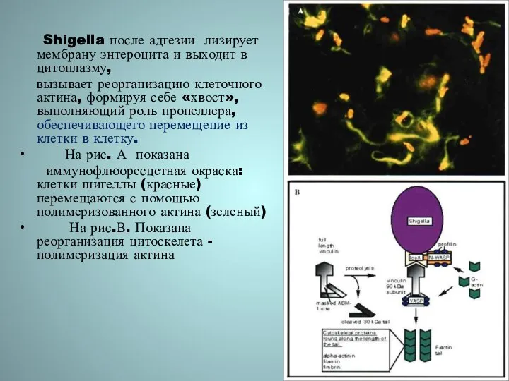 Shigella после адгезии лизирует мембрану энтероцита и выходит в цитоплазму, вызывает