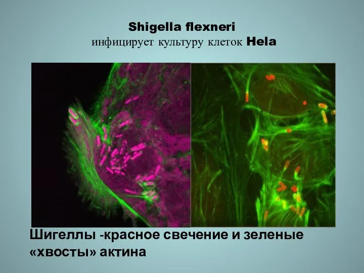 Shigella flexneri инфицирует культуру клеток Hela Шигеллы -красное свечение и зеленые «хвосты» актина