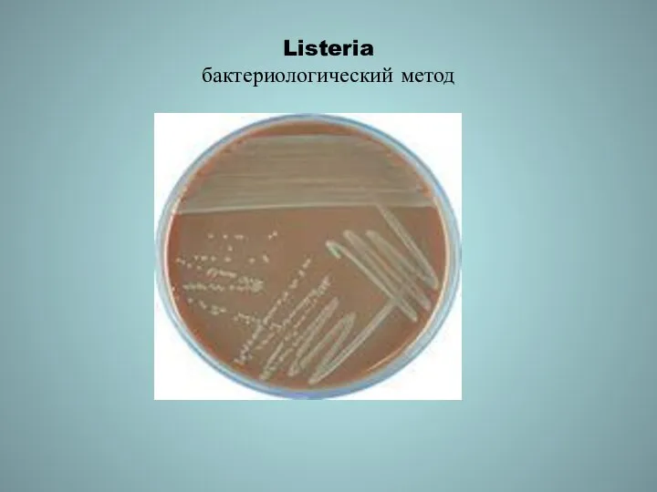 Listeria бактериологический метод