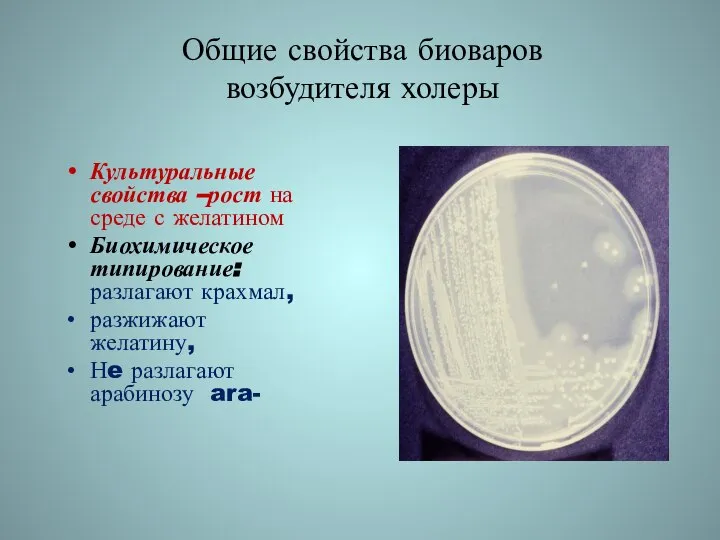 Общие свойства биоваров возбудителя холеры Культуральные свойства –рост на среде с